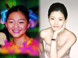 明星整形前后照片,揭秘美丽蜕变之路